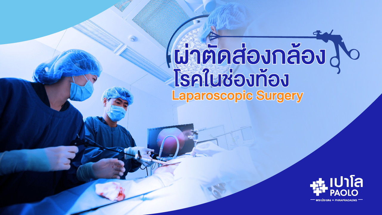 การผ่าตัดส่องกล้องช่องท้อง (Laparoscopic Surgery)